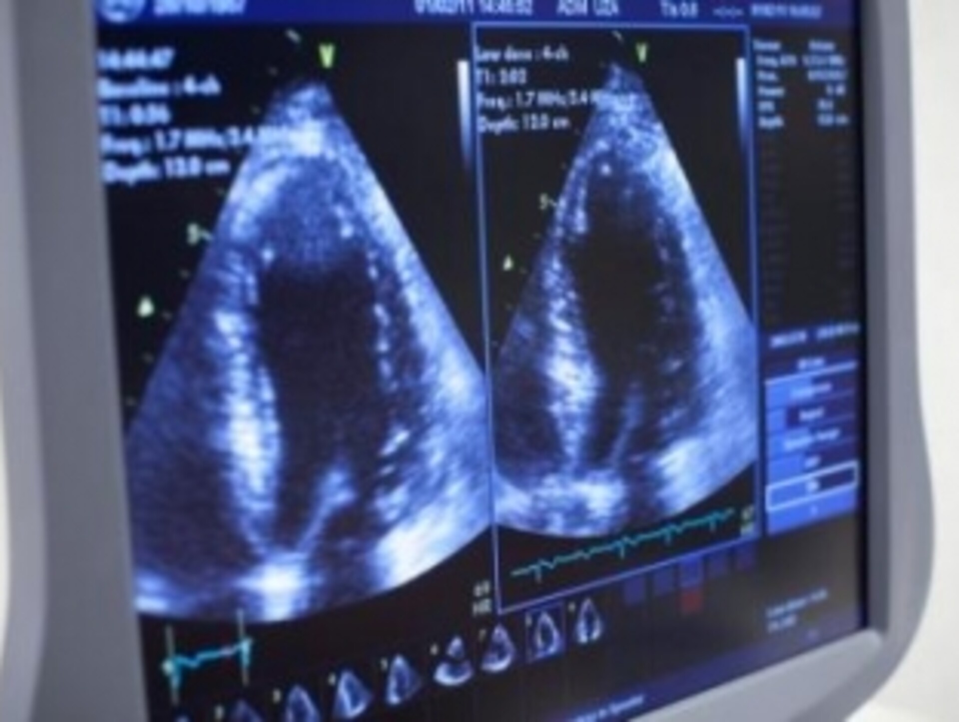 Artikel Medisch Contact: WIN-WIN nieuwkomers opleiden tot echocardiografist